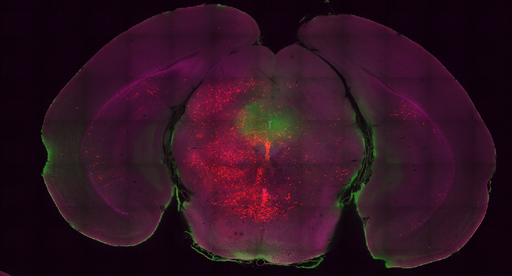 Whole-brain confocal imaging of mouse retrograde transynaptic tracing - ace-bug-wit