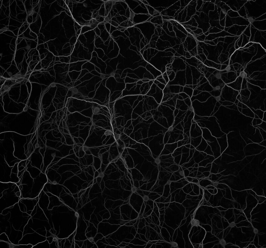 Confocal microscopy of mouse hippocampal neurons - ace-nut-gel